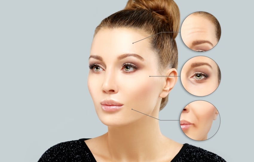 Highlighting three areas where Botox makes a woman look younger, with tighter skin