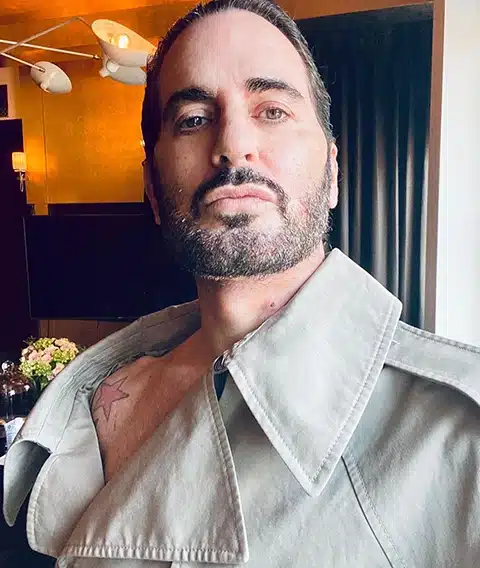 Marc Jacobs Facelift After Photo