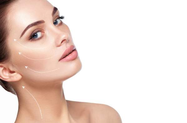 A young woman who has had a mini facelift