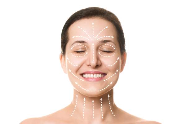 A woman with lines drawn on her face showing where the facelift will take place