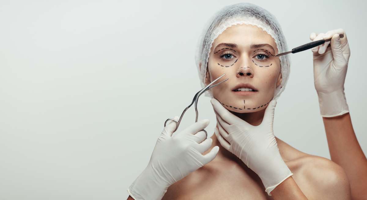 A woman with lines drawn on her face for a facelift