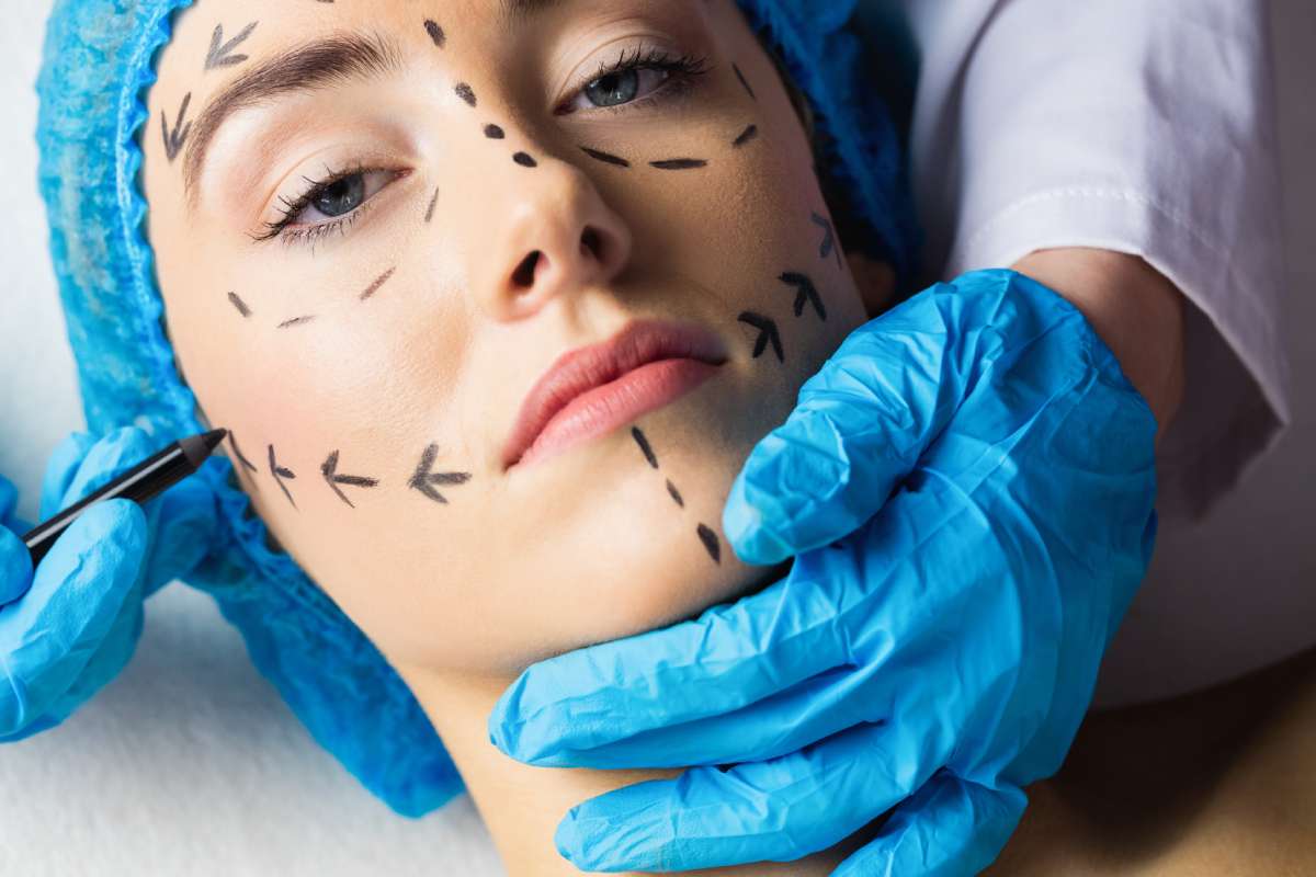 A woman with lines being drawn on her face for plastic surgery